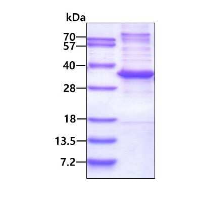 SDS-PAGE Recombinant Human MED7 His Protein